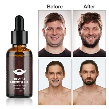 5pcs/set Profissional Barba Crescimento Kit de Crescimento do Cabelo Enhancer Conjunto Essencial de Nutrir a Barba de Petróleo Monte Pente Rolo de Cuidados para Homens